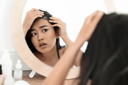 The Impacts of Stress on Hair Loss